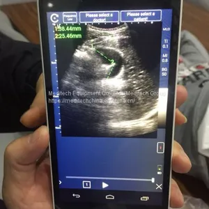 Meditech C-Scan Handheld Touch Screen Color Ultrasound Scanner Medical Supply thumbnail-2