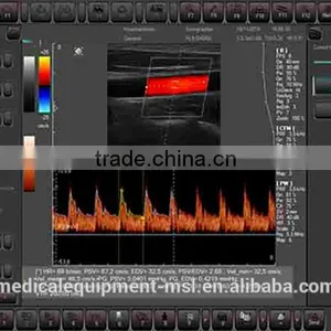 3D Color Doppler Ultrasound Machine With Touch Screen With Competitive Price MSLCU22-N thumbnail-5