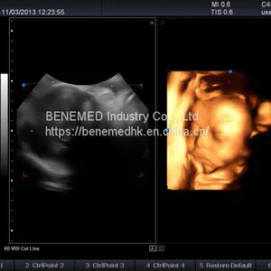 Premium 4D Color Doppler Ultrasound Scanner thumbnail-2