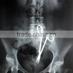China Radiografia de Abdomen Film KND-A/F CE thumbnail-1