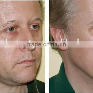 rf Age Spot Removal rf Facial Machine/intracel Fractional rf Microneedle Machine thumbnail-6