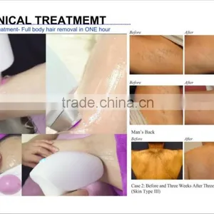 Hifu rf Vacuum Cavitation Lipo Freeze Cellulite Reduction Machine Therapy Machine for Body Shape thumbnail-3