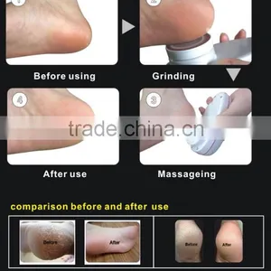 Home Use Prompt Blood Circulation Beauty Equipments Exfoliating Scrub Machine thumbnail-4