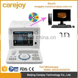 Ultrasound Machine Ultrasonic Diagnostic Scanner System RUS-6000D With 3.5MHz Convex Probe External 3D Optional thumbnail-1