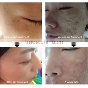 Clinic Use Fractional rf Microneedle Scar Removal Machine thumbnail-6
