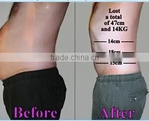 Best Price of Cryotherapy Fat Freeze Machine for Fast and Effective Cellulite Removal thumbnail-4