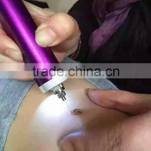 High Frequency Spot Removal Pen Speckle Removal thumbnail-5