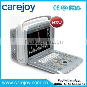 CE ISO Certified Portable Color Doppler 3D/4D Ultrasound Diagnostic System Machine thumbnail-1