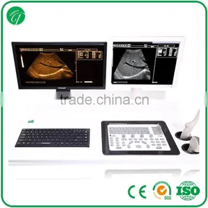 Portable Digital 15" LCD Trolley Ultrasound Scanner Price With Workstation thumbnail-4