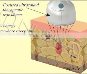 The Most Advanced Non Surgical Fat Reduction and Body Sculpting System Machine for Fat Loss thumbnail-4