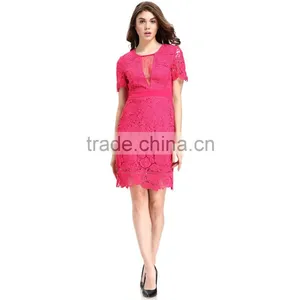 Fashion Lace Patchwork Short Frock Lady Image Skater Dress thumbnail-3