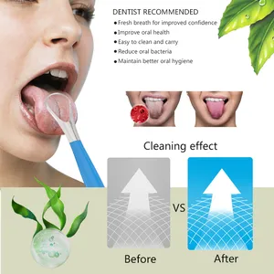 Hot Sell Stainless Steel Tongue Cleaner Scraper With Comfortable Handle for Oral Care thumbnail-3