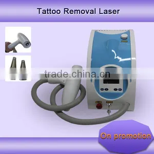 Q Switch Laser Machine 2015 Newest Epilator Home Use Q Switch Nd Yag Laser Laser Tattoo Removal Equipment Tattoo Removal System / Q Switch Nd Yag Laser 2000mj thumbnail-1