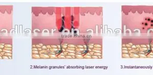 2017 Laser White Porcelain Doll Clinic Use thumbnail-6