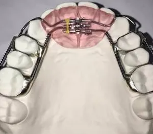 China Dental Laboratory - China Digital Dental Lab China Dental Lab Looks for Cooperation thumbnail-2