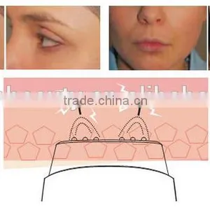 Mini rf Best rf Skin Tightening Face Lifting Machine thumbnail-5