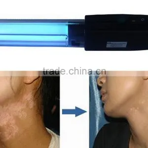 Hand Held NB UVB Phototherapy 311nm Lamp for Vitiligo Eczema Psoriasis thumbnail-3