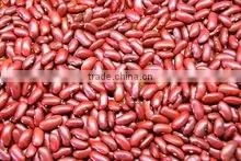 SPECKLED KIDNEY BEANS thumbnail-1