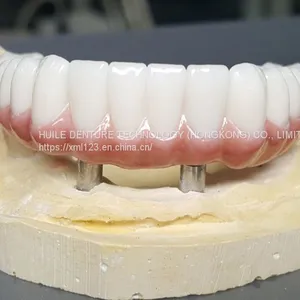 Dental Pfm Crown From China Dental Lab thumbnail-2