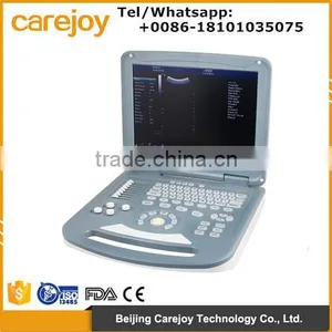 Laptop 15 Inch LCD Color Doppler Ultrasound Diagnostic System RUS-9000-2 With CE ISO Approved thumbnail-1
