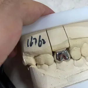 Myy International Dental Lab All on 4/6 Dental Manufacturer thumbnail-4