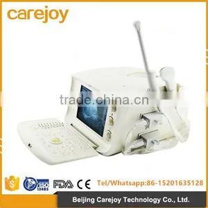 Cheap Prices of Medical Ultrasound Machine for Pregnancy thumbnail-1