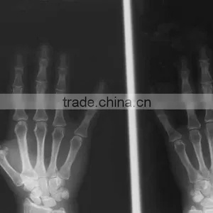 Medical Dry Films,medical Films.fuji Dry Film thumbnail-2