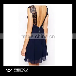 European Style Women Sleeveless Casual Lace Dress thumbnail-3