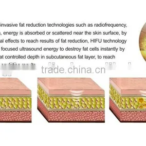 New Tech! Liposonix HIFU for Face Body Slimming Machine/liposunic Ultrasound Machine/reduce Cellulite thumbnail-3