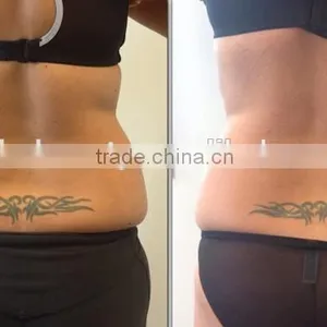 Distributor Wanted Cryolipolysis Fat Freeze Loss Weight Slimming Equipment/fat Freeze Belt/slim Freezer Weight Loss Machine thumbnail-6