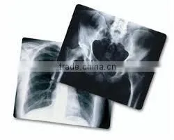 Japan Film Fuji X-ray Film Konica Dry Films thumbnail-5