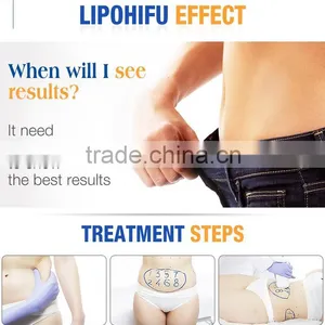 Gold Search Machine Ultrashape HIFU Painless Fat Local Fat Removal Removal Slimming Machine -01 Forehead Wrinkle Removal 50 / 60Hz thumbnail-4