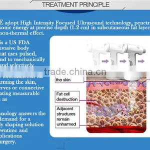 High Intensity Focused Ultrasound High Performance Hifu Fat Weight Loss / Ultrasound Weight High Focused Ultrasonic Loss Machine / Hifu Slimming Machine With Factory Price thumbnail-5