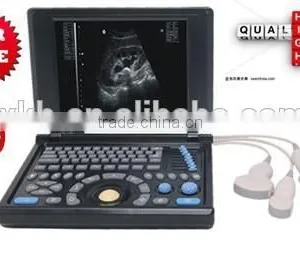 100% Guarantee CE Approved Laptop Portable Ultrasound Scanner 4 Optional Probes Ultrasound System 18 Month Warranty thumbnail-1