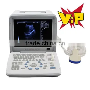 2016 Cheapest Portable Ultrasounic Diagnose Scanner Machine System With Convex/Linear/Cardic/Rectal Transducer Connector thumbnail-1