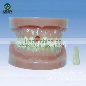 BIX - L1019 Removable no Root Standard Tooth Model thumbnail-1