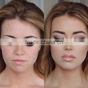 Freckle Moles Removal Laser Pen Face Spots Removal the New 2015 thumbnail-2