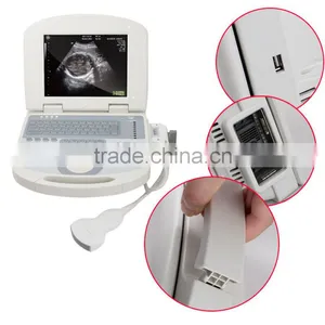 Cheap Price Portable Ultrasound Scanner With 3.5Mhz Convex Probe Manufacturer thumbnail-3