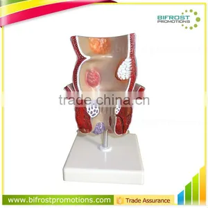 Rectum Pathology Organs Education Human Body Anatomy Model thumbnail-1