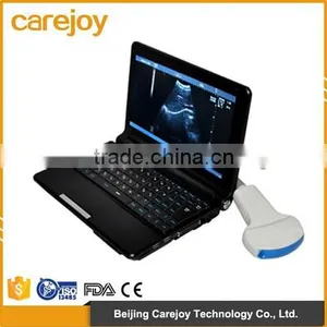 CE&ISO Certification 3.5Mhz Convex Probe Battery 10 Inch Laptop Ultrasound Machine thumbnail-1