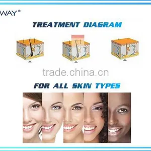 2016 Best Seller Painless and Permanent Depilator Professional 808 Home Use Diode Laser Hair Removal Device thumbnail-5