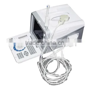 Low Cheap Portable Ultrasound Scanner 10 Inch Optional Video Thermal Recorder thumbnail-2