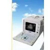 Portable B-type Ultrasonic Diagnostic Apparatus thumbnail-1