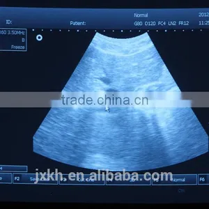 3D Full Digital Portable Ultrasound Scanner With PC Platform thumbnail-6