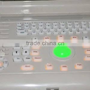 2016 CE Approved Digital Portable Style Ultrasound Machine/Scanner With Cheap Price thumbnail-6