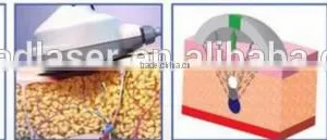 2016 New High Quality Professional 3D Ultrashape Machine to Loss Weight thumbnail-5