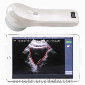 Sonostar Ultrasound 2 in 1 Double Head Color Doppler Convex & Linear Ultrasound Machine Scanner thumbnail-1