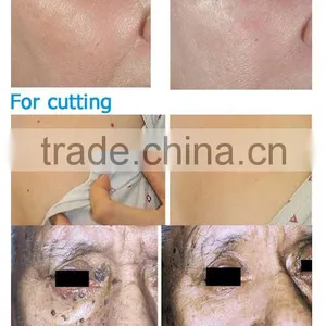 High Frequency  High Quality Hifu Vaginal Tightening Machine 0.2-3.0J thumbnail-4