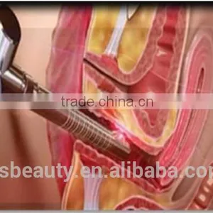 OEM Multifunction Clinical/medical/hospital Laser Vaginal Tightening Machine thumbnail-5