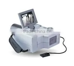 Digital X-Ray (ADX 4000 ) thumbnail-1